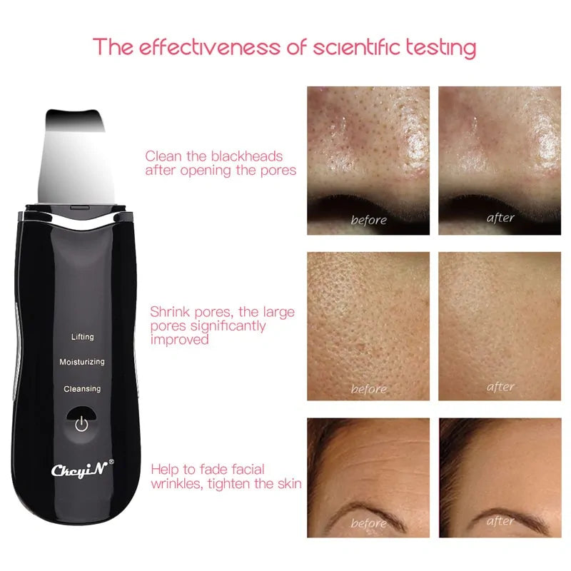 Ultrasonic Skin Scrubber + Skin Rejuvenation Nano Face Mist Steamer